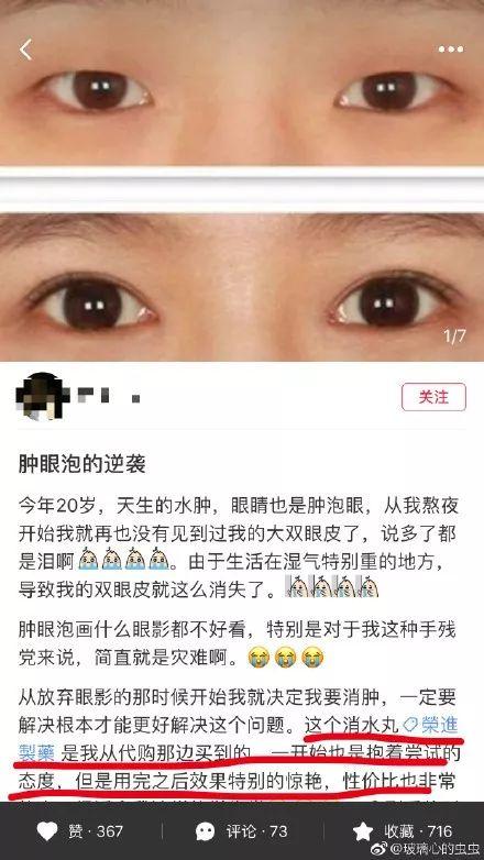 小红书热门动漫美瞳推荐，瞬间带你穿越二次元世界！